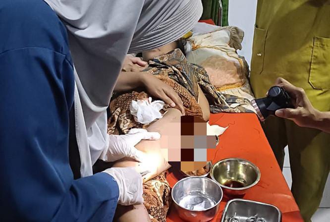 Seorang Ibu di Riau Nekat Rebut Anaknya Dari Terkaman Buaya